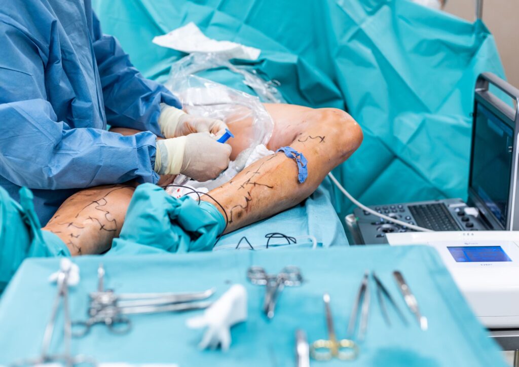 Cirurgia Vascular: O que é?